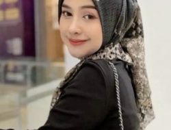 Wajah Ria Ricis Berubah Drastis, Akui Operasi Hidung Demi Bisa Bernapas Lega